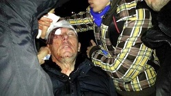 Опубліковано відео побитого Луценко та активістів